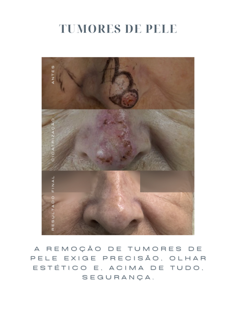 Ramon (17)